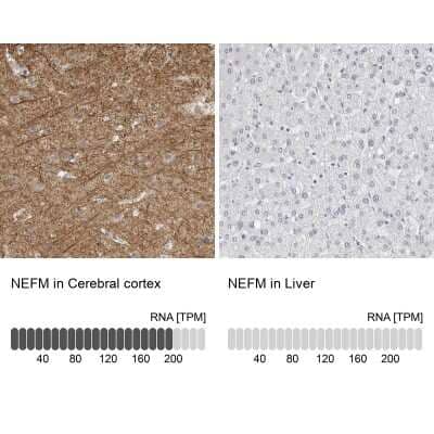 Immunohistochemistry-Paraffin: NF-M Antibody [NBP1-87754]