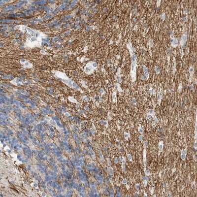 Immunohistochemistry-Paraffin: NF-M Antibody [NBP1-87754]