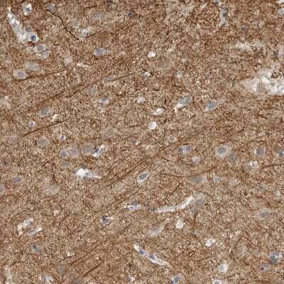 Immunohistochemistry-Paraffin: NF-M Antibody [NBP1-87754]
