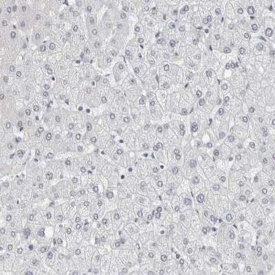 Immunohistochemistry-Paraffin: NF-M Antibody [NBP1-87754]