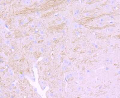 Immunohistochemistry-Paraffin: NF-M Antibody (JM11-20) [NBP2-66978]