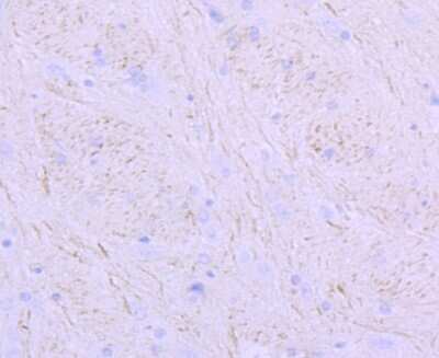 Immunohistochemistry-Paraffin: NF-M Antibody (JM11-20) [NBP2-66978]