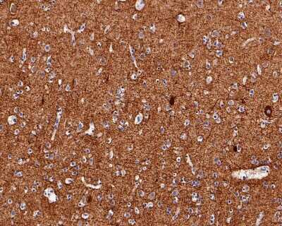 Immunohistochemistry-Paraffin: NF-M Antibody (JM11-20) [NBP2-66978]
