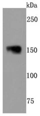 Western Blot: NF-M Antibody (JM11-20) [NBP2-66978]