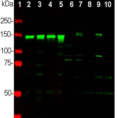 Western Blot: NF-M Antibody [NB300-222]