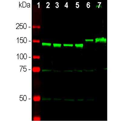 Western Blot: NF-M Antibody [NB300-133]