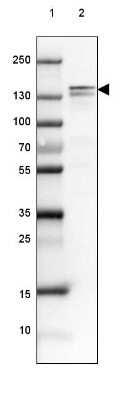 Western Blot: NF-M Antibody [NBP1-87753]