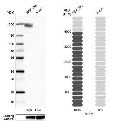Western Blot: NF-M Antibody [NBP1-87753]