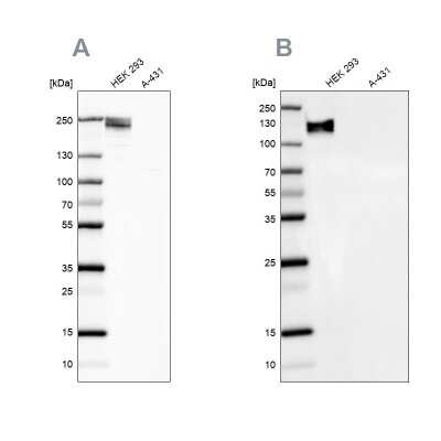 Western Blot: NF-M Antibody [NBP1-87753]