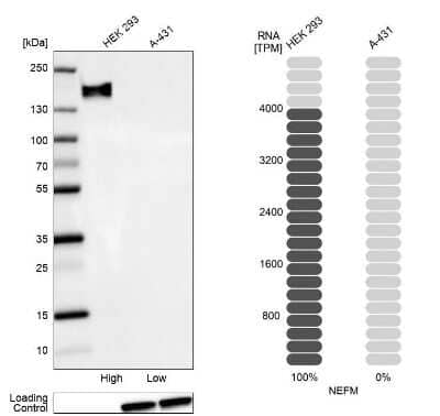 Western Blot: NF-M Antibody [NBP1-87754]