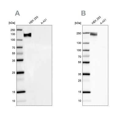 Western Blot: NF-M Antibody [NBP1-87754]