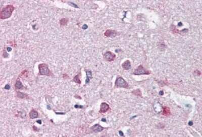 Immunohistochemistry: NF2/Merlin Antibody [NB100-93527]