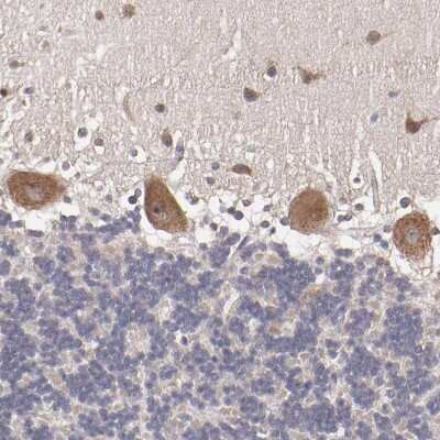 Immunohistochemistry-Paraffin: NF2/Merlin Antibody [NBP1-87757]
