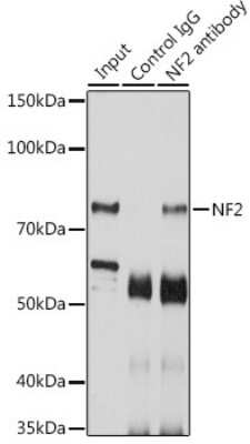 Immunoprecipitation: NF2/Merlin Antibody - BSA Free [NBP3-03740]