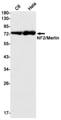 Western Blot: NF2/Merlin Antibody (S07-1A6) [NBP3-19715]