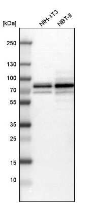 Western Blot: NF2/Merlin Antibody [NBP1-87757]