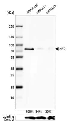 Western Blot: NF2/Merlin Antibody [NBP1-87757]