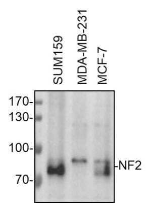Western Blot: NF2/Merlin Antibody [NBP1-87757]