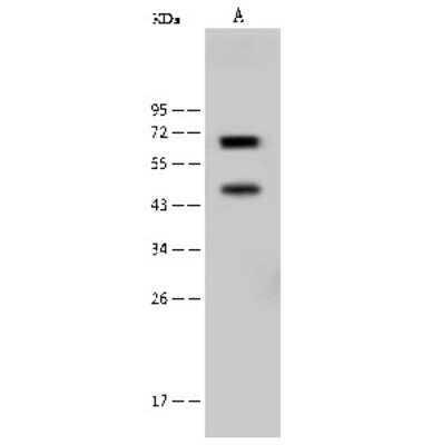 Western Blot: NF2/Merlin Antibody [NBP2-99421]