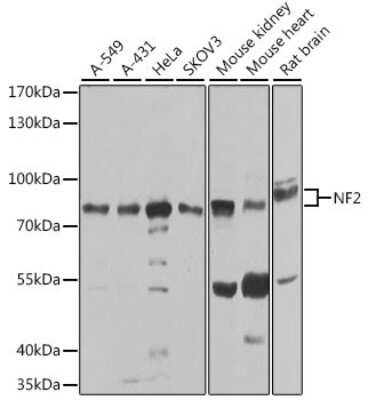 Western Blot: NF2/Merlin AntibodyBSA Free [NBP3-03740]