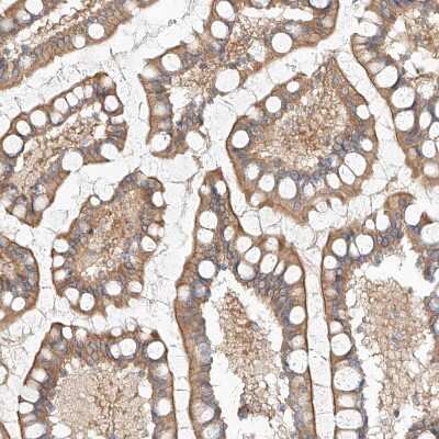 Immunohistochemistry-Paraffin: NFAM1 Antibody [NBP1-84424]