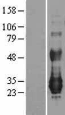 Western Blot: NFAM1 Overexpression Lysate [NBL1-13607]