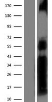 Western Blot: NFATC2/NFAT1 Overexpression Lysate [NBP2-05154]