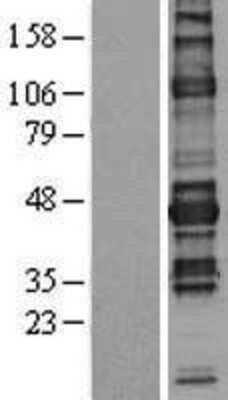 Western Blot: NFATC1/NFAT2 Overexpression Lysate [NBL1-13608]