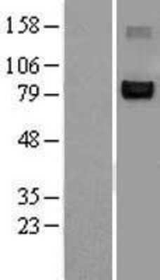 Western Blot: NFATC1/NFAT2 Overexpression Lysate [NBL1-13609]