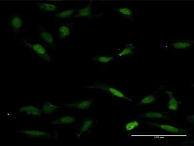 Immunocytochemistry/ Immunofluorescence: NFAT5 Antibody [H00010725-B01P]