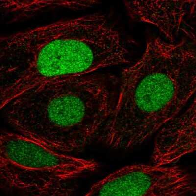 Immunocytochemistry/ Immunofluorescence: NFAT5 Antibody [NBP2-49612]