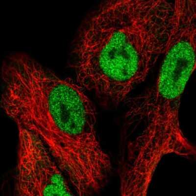 Immunocytochemistry/ Immunofluorescence: NFAT5 Antibody [NBP2-56674]