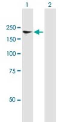 Western Blot: NFAT5 Antibody [H00010725-B01P]