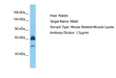 Western Blot: NFAT5 Antibody [NBP1-80257]