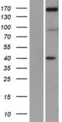 Western Blot: NFAT5 Overexpression Lysate [NBP2-09383]