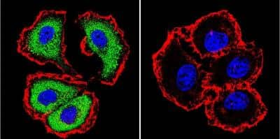 Immunocytochemistry/ Immunofluorescence: NFATC1/NFAT2 Antibody (7A6) [NB300-620]