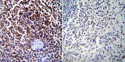 Immunohistochemistry-Paraffin: NFATC1/NFAT2 Antibody (7A6) [NB300-620]