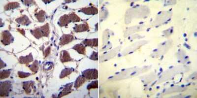 Immunohistochemistry-Paraffin: NFATC1/NFAT2 Antibody (7A6) [NB300-620]