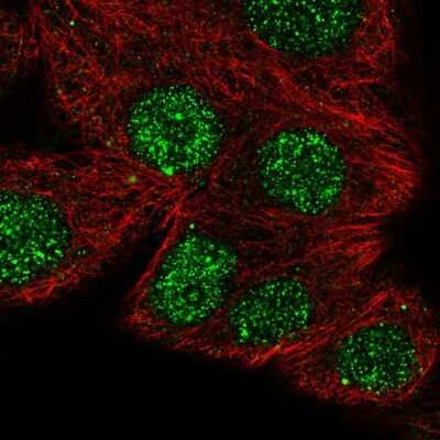 Immunocytochemistry/ Immunofluorescence: NFATC1/NFAT2 Antibody [NBP2-57739]