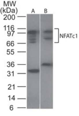 Western Blot: NFATC1/NFAT2 Antibody [NB100-56732]