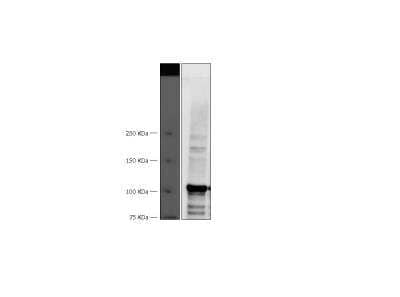 Western Blot: NFATC1/NFAT2 Antibody [NB100-56732]