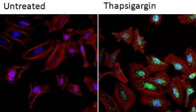 Immunocytochemistry/ Immunofluorescence: NFATC2/NFAT1 Antibody (25A10.D6.D2) - BSA Free [NB300-504]