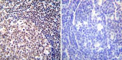 Immunohistochemistry-Paraffin: NFATC2/NFAT1 Antibody (25A10.D6.D2) - BSA Free [NB300-504]