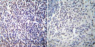 Immunohistochemistry-Paraffin: NFATC2/NFAT1 Antibody (25A10.D6.D2) - BSA Free [NB300-504]