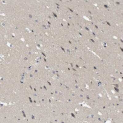 Immunohistochemistry-Paraffin: NFATC2/NFAT1 Antibody [NBP1-82582]