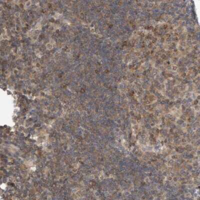 Immunohistochemistry-Paraffin: NFATC2/NFAT1 Antibody [NBP1-82582]