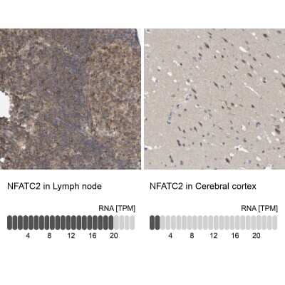 Immunohistochemistry-Paraffin: NFATC2/NFAT1 Antibody [NBP1-82582]