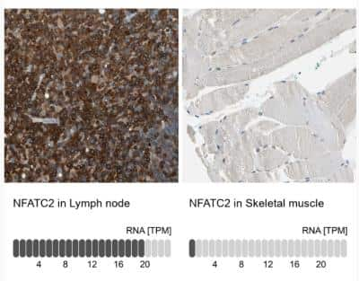 Immunohistochemistry-Paraffin: NFATC2/NFAT1 Antibody [NBP1-82583]