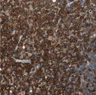 Immunohistochemistry-Paraffin: NFATC2/NFAT1 Antibody [NBP1-82583]