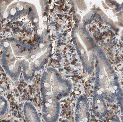 Immunohistochemistry-Paraffin: NFATC2/NFAT1 Antibody [NBP1-82583]